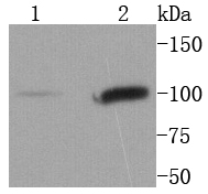 STAT6 Rabbit mAb