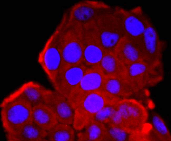 CDK1 Rabbit mAb