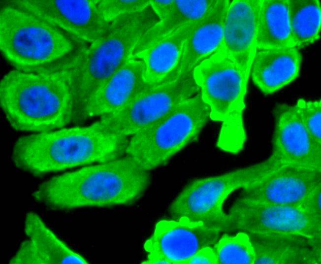 Hsp90 beta Rabbit mAb