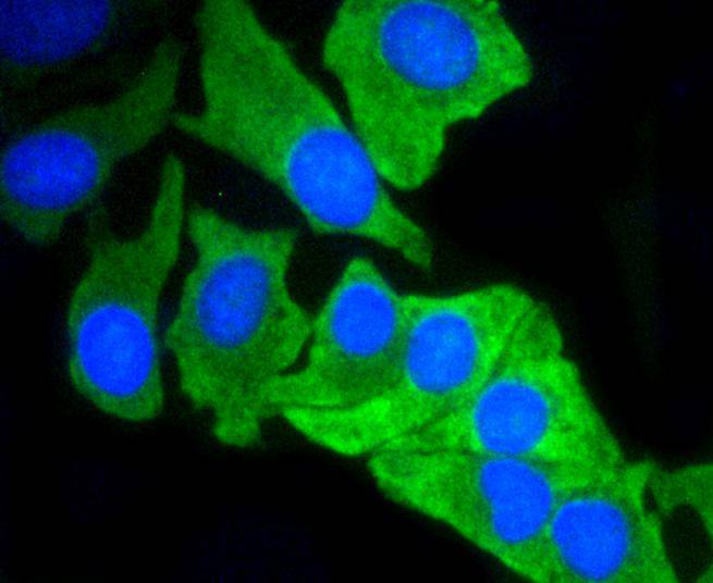 MCL1 Rabbit mAb