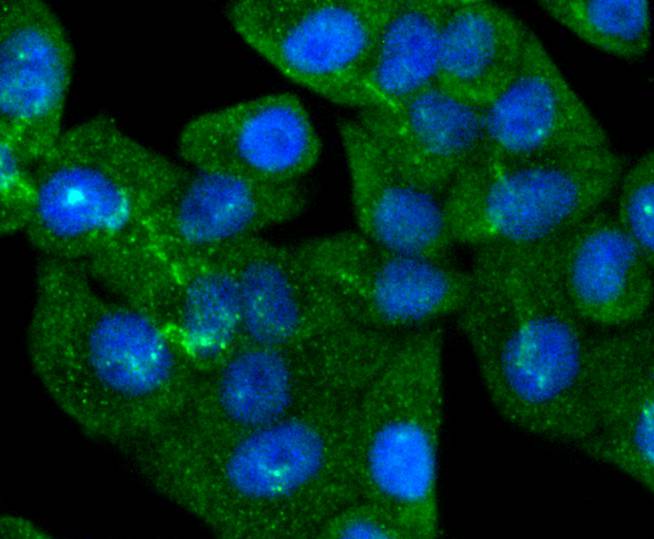 Smad5 Rabbit mAb