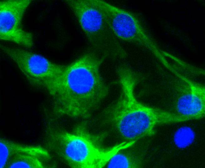 Desmin Rabbit mAb