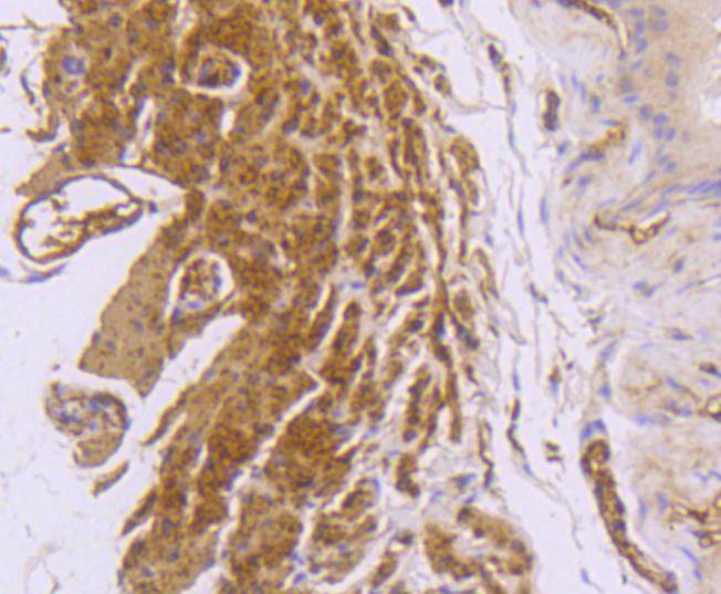 Desmin Rabbit mAb