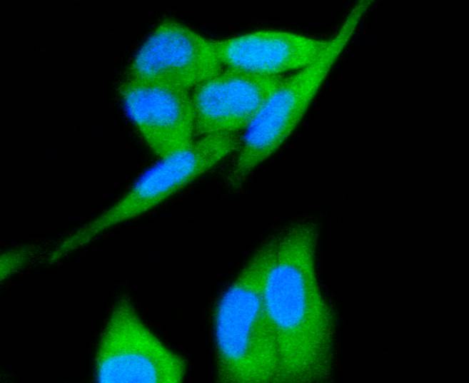 Met(C-Met) Rabbit mAb