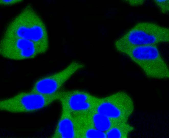 Calmodulin Rabbit mAb