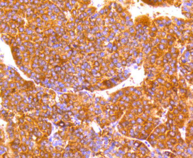 LDL Receptor Rabbit mAb