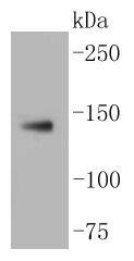 LDL Receptor Rabbit mAb