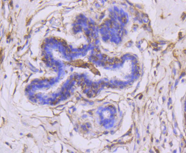 MMP14 Rabbit mAb