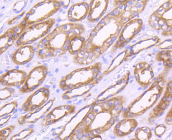 MMP14 Rabbit mAb