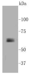 MMP14 Rabbit mAb