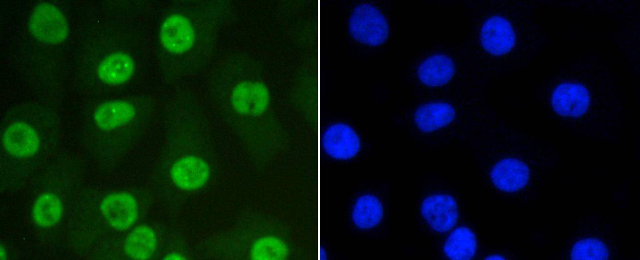 SUMO-1 Rabbit mAb