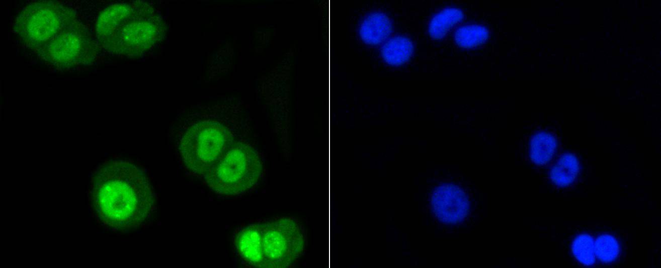 SUMO-1 Rabbit mAb