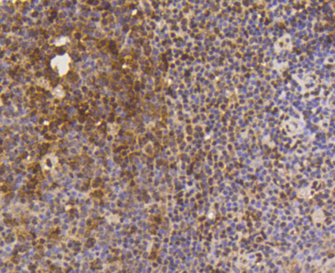 SUMO-1 Rabbit mAb