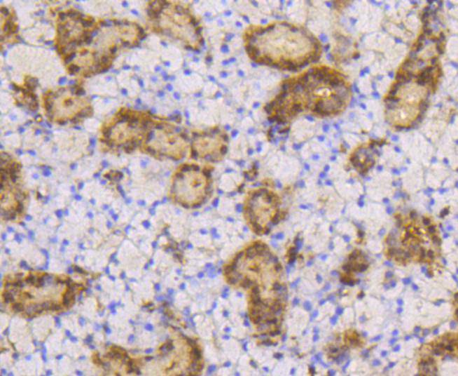 SUMO-1 Rabbit mAb