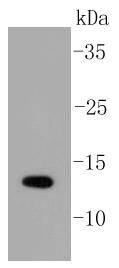 SUMO-1 Rabbit mAb