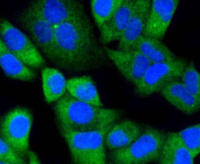 Notch 1 Rabbit mAb