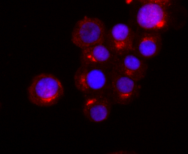 Synaptophysin Rabbit mAb