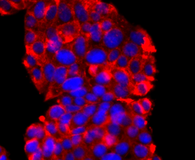 Synaptophysin Rabbit mAb