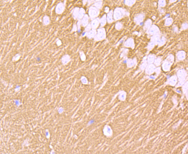 Synaptophysin Rabbit mAb