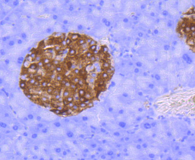 Synaptophysin Rabbit mAb