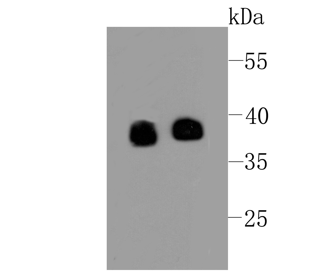 Synaptophysin Rabbit mAb