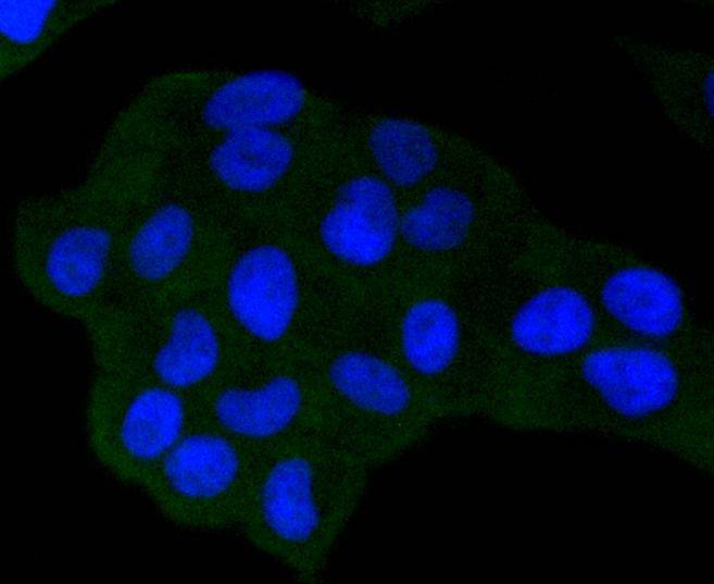 NADPH oxidase 4/NOX4 Rabbit mAb