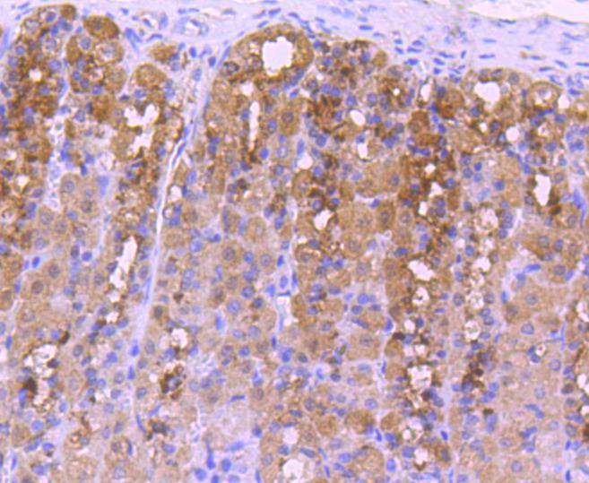 NADPH oxidase 4/NOX4 Rabbit mAb