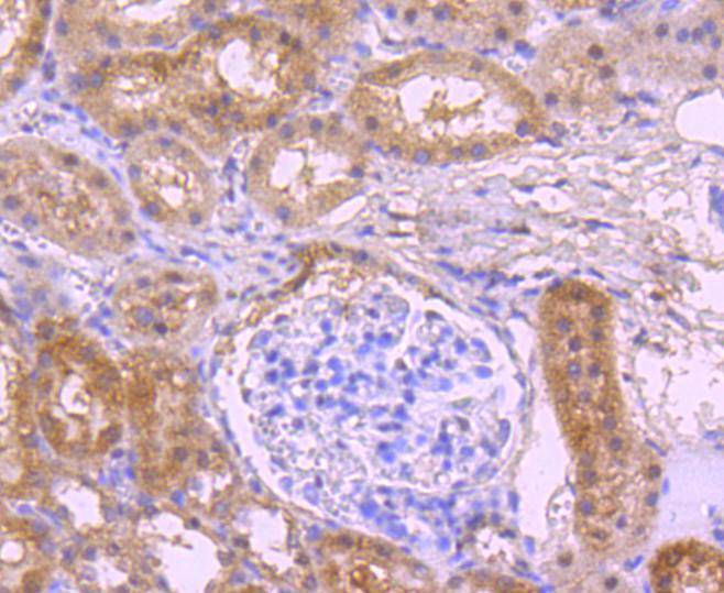 NADPH oxidase 4/NOX4 Rabbit mAb