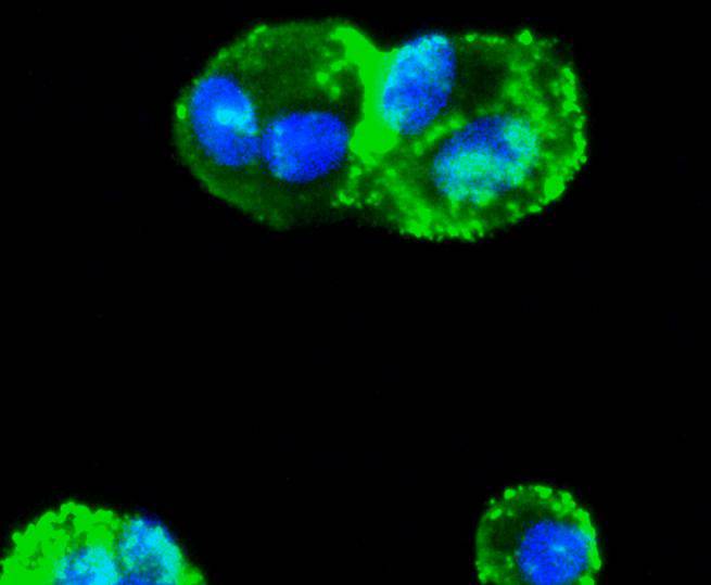 Smad3 Rabbit mAb