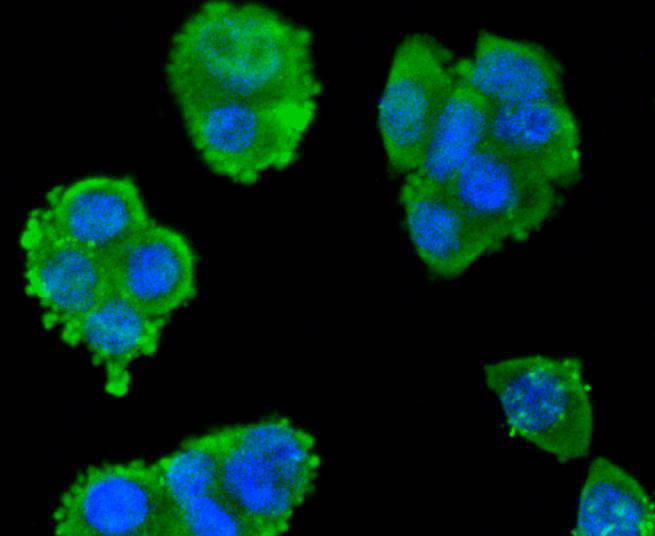 Smad3 Rabbit mAb