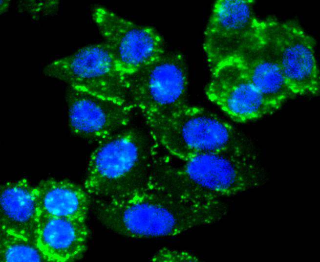 Smad3 Rabbit mAb