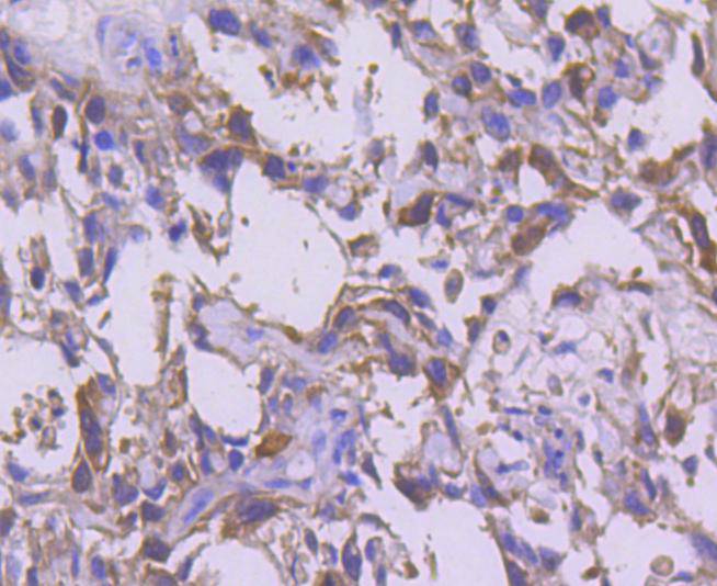 CDK1 Rabbit mAb