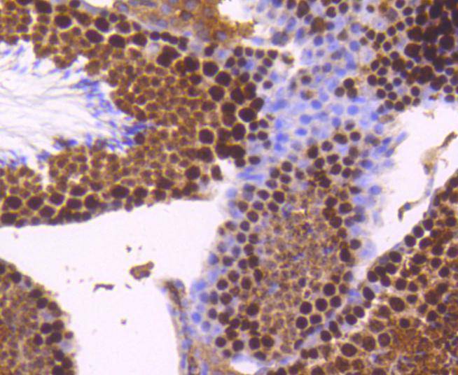 Topoisomerase Ⅱ alpha Rabbit mAb