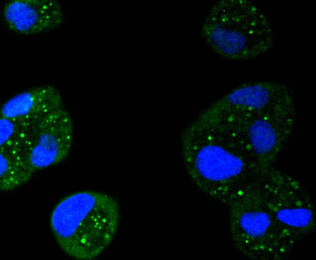 STAT6 Rabbit mAb