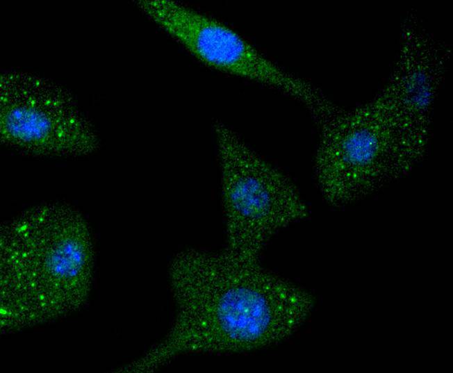 STAT6 Rabbit mAb