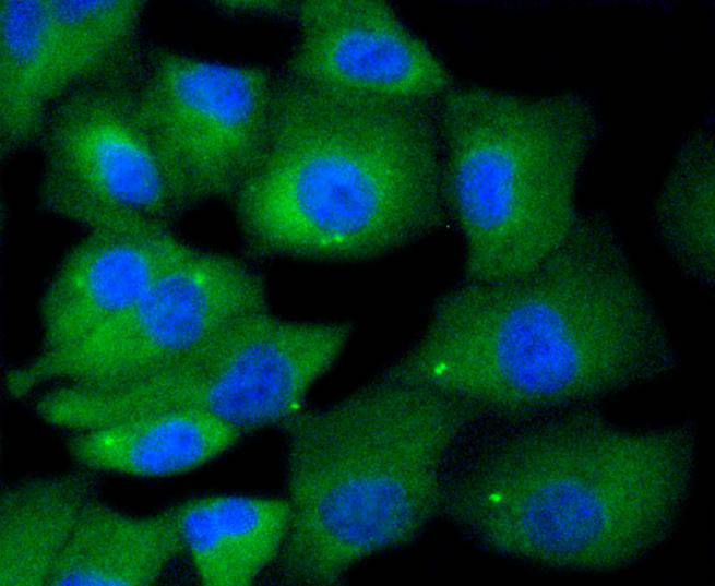 MKLP1 Rabbit mAb