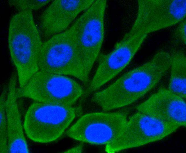 GSK3 beta Rabbit mAb