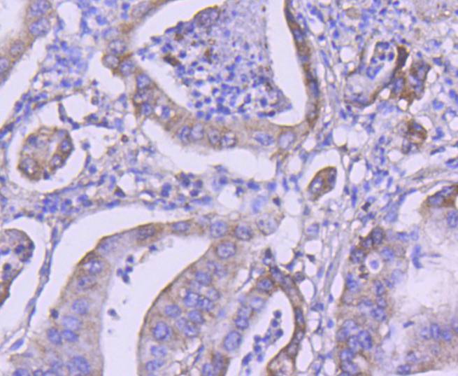 PI 3 Kinase Class 3 Rabbit mAb