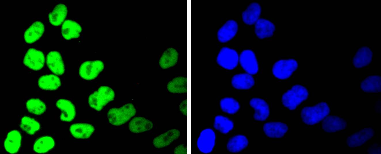 HDAC2 Rabbit mAb