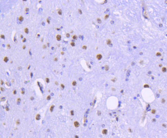 HDAC2 Rabbit mAb