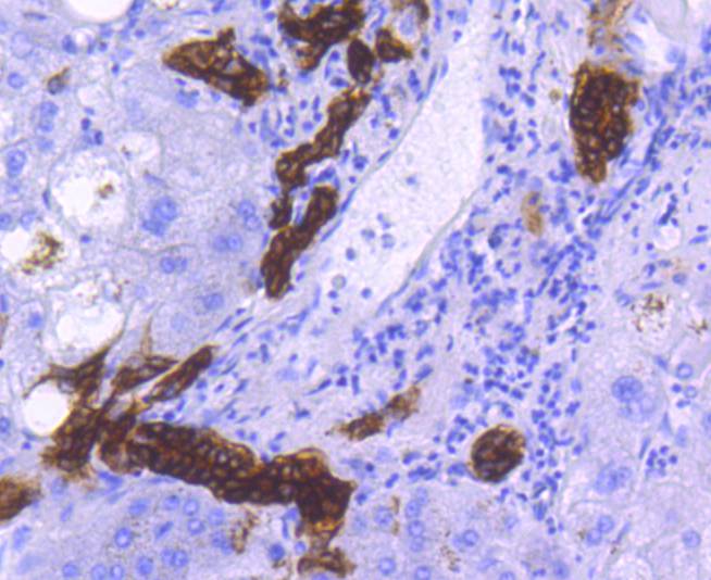 EpCAM Rabbit mAb