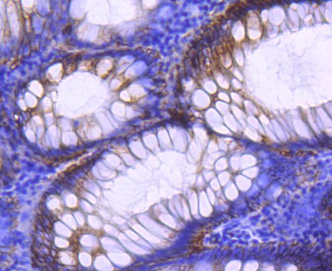 EpCAM Rabbit mAb