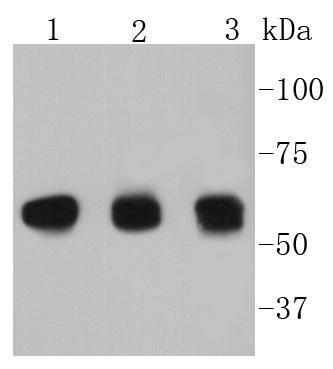 Cyclin B1 Rabbit mAb