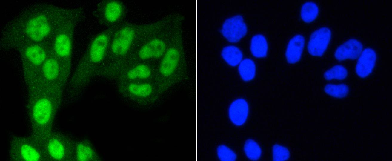 YAP1 Rabbit mAb