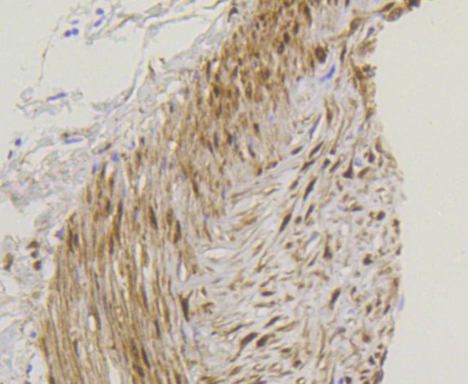 YAP1 Rabbit mAb