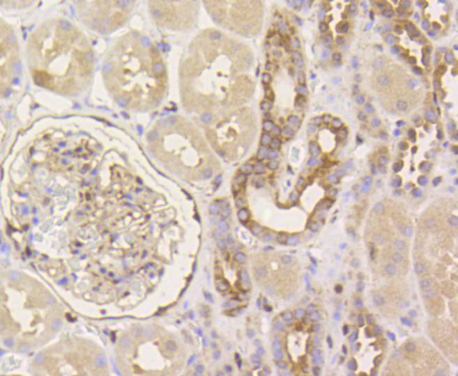 YAP1 Rabbit mAb