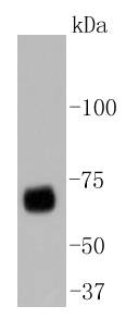 YAP1 Rabbit mAb