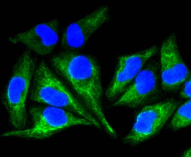 Cytokeratin 8+18 Rabbit mAb