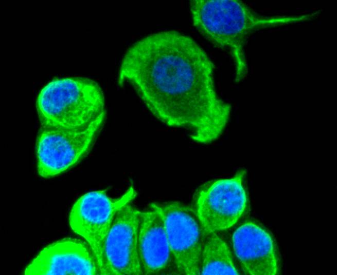 Cytokeratin 8+18 Rabbit mAb