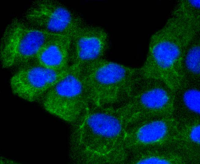 Cytokeratin 8+18 Rabbit mAb